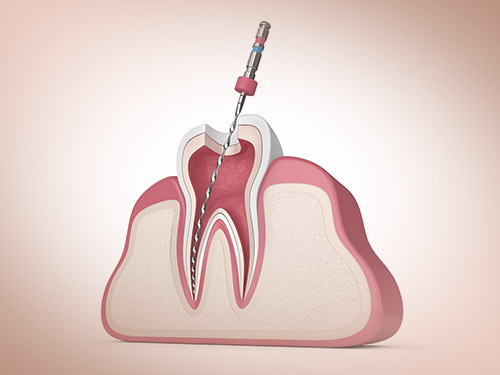 Endodontia